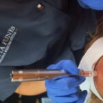 Tratamiento Facial Bioregenerador Cutáneo, el futuro del rejuvenecimiento