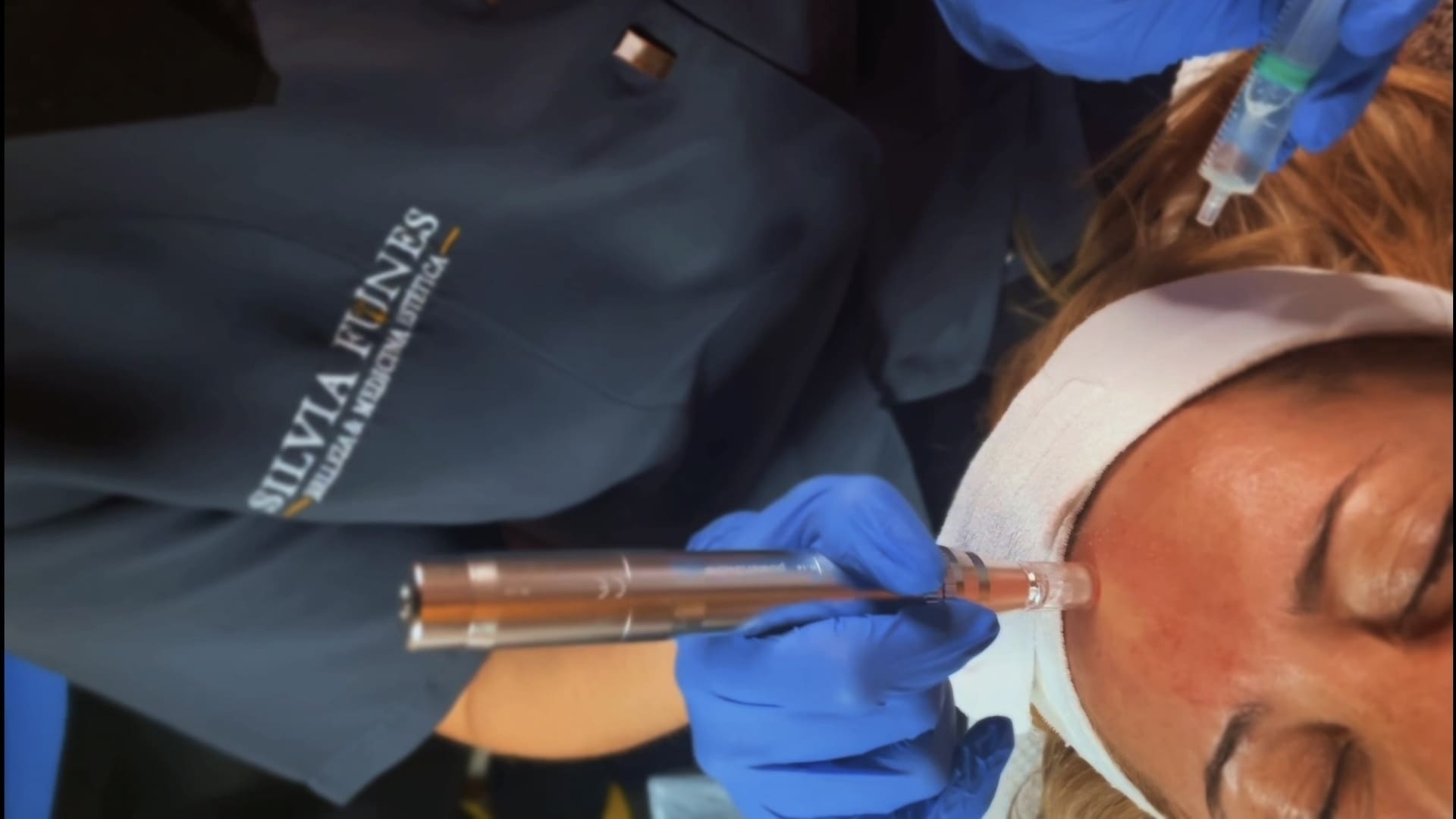 Tratamiento Facial Bioregenerador Cutáneo, el futuro del rejuvenecimiento