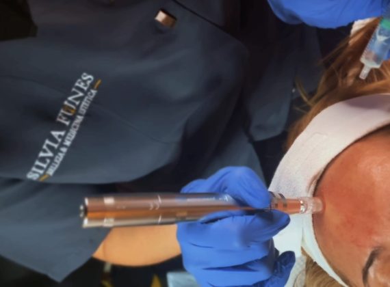 Tratamiento Facial Bioregenerador Cutáneo, el futuro del rejuvenecimiento